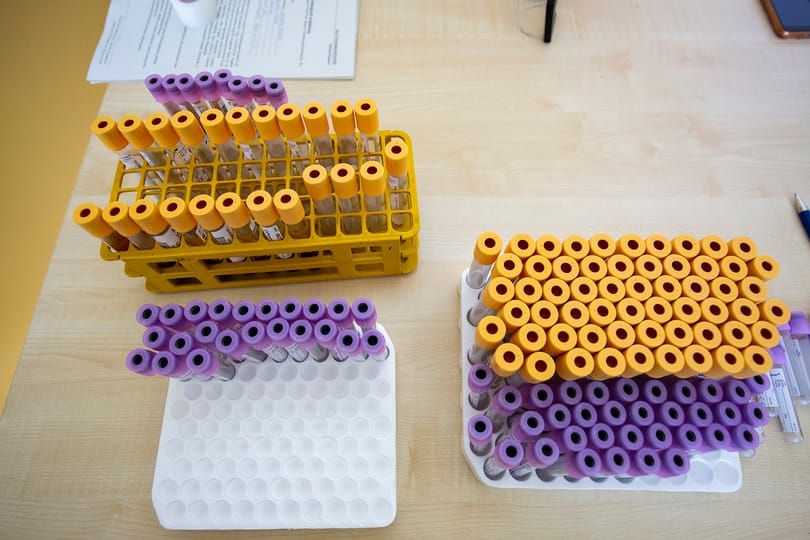 Minden Kínába érkező külföldi számára kötelező lesz az anális koronavírusteszt