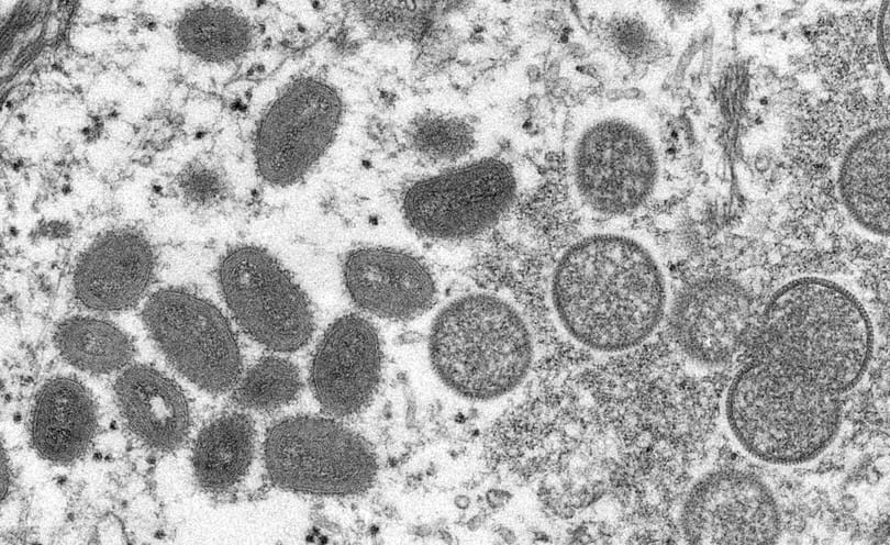 Ebola, majomhimlő, koronavírus – a jövőben egyre több ilyen betegség ütheti fel a fejét
