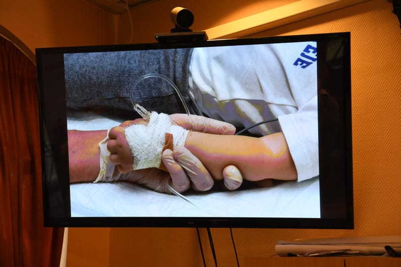 Mínusz 60 fokra lehűtve érkezett Zente forradalmi gyógyszere, ő a negyedik európai, aki megkapta