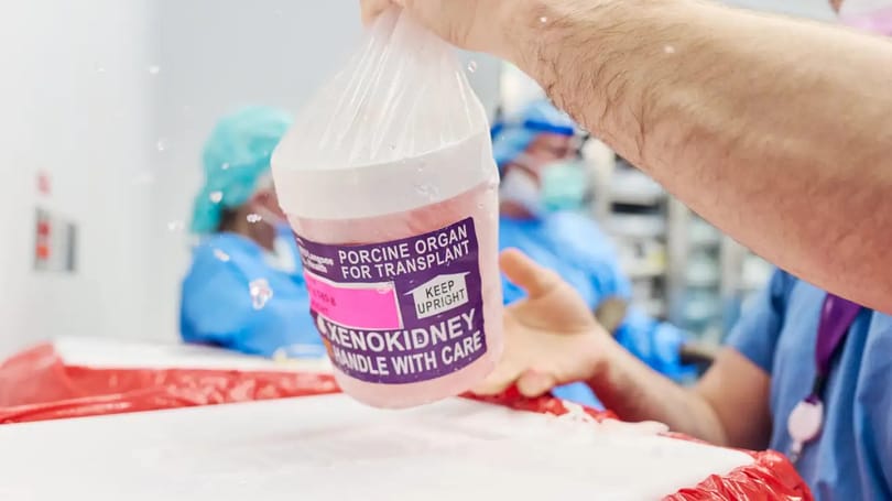 Ilyen még nem volt: egyszerre ültettek be egy emberbe sertésvesét és szívpumpát