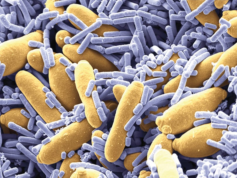 WHO: ne szedjünk antibiotikumokat a kólibaktérium ellen
