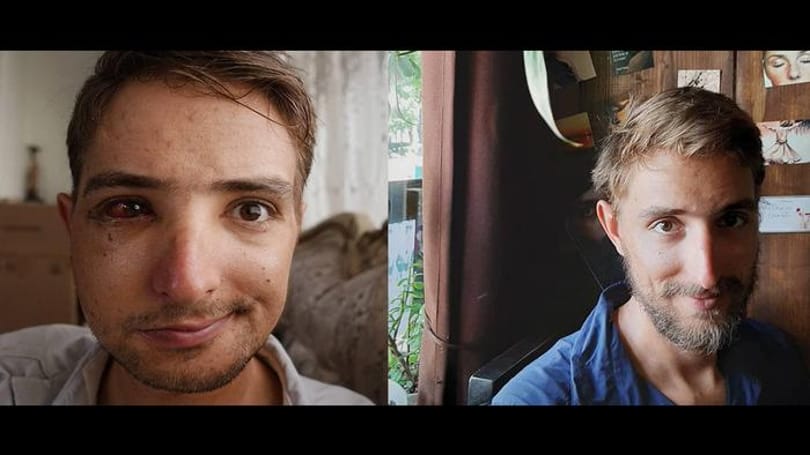 Megverték és kirabolták Iránban a rákkal küzdő német kerekezőt