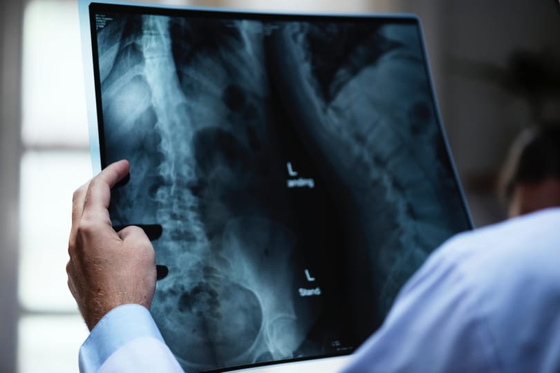 MRI-t gyártó-forgalmazó cégeket büntetett 1,6 milliárdra a GVH