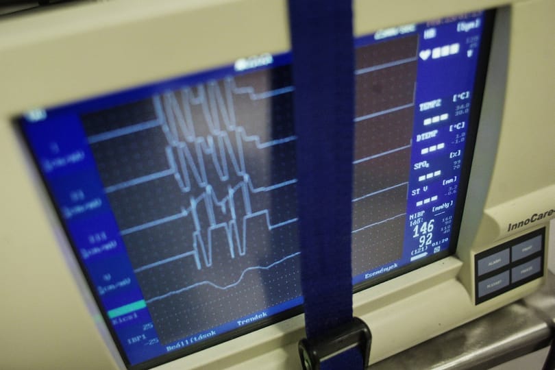 Kellene valahonnan 50 milliárd forint a kórházaknak