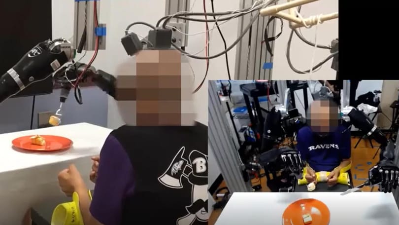 Elektródát ültettek az agyába, 30 év után tudott önállóan enni egy lebénult férfi – videó