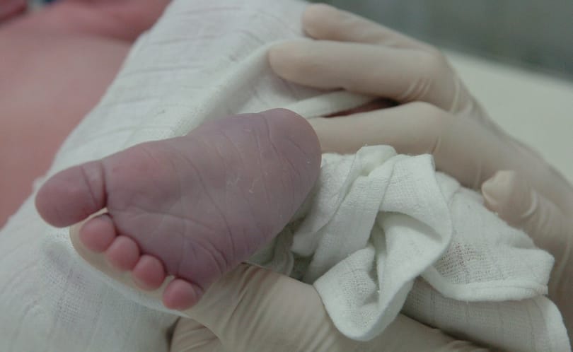 Döbbenetes szám: 7200 csecsemő születik halva naponta a világon