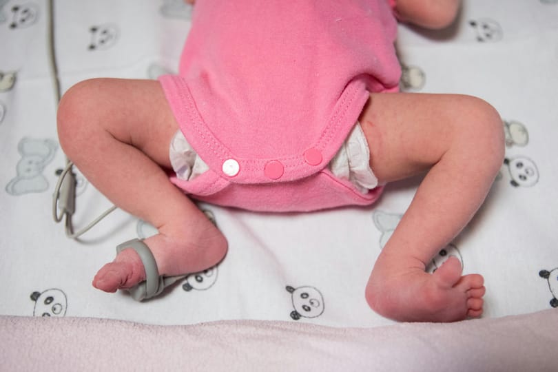 Csökkenhet a védőoltás hatása a csecsemőknél, ha antibiotikummal kezelik őket