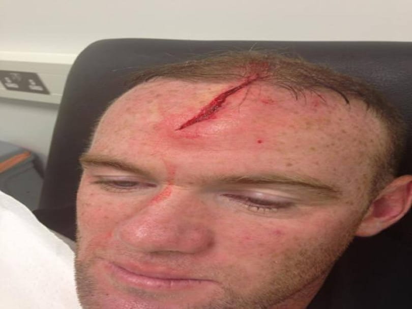 Fotó: szétszakadt Rooney feje