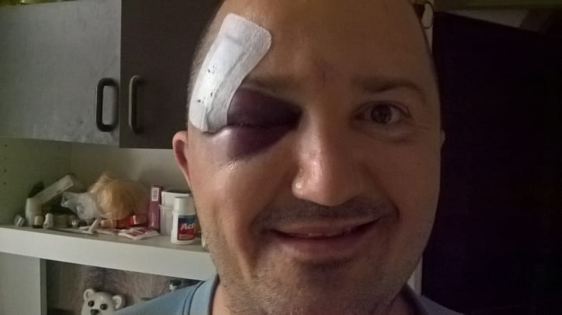 Megvertek egy férfit a szombati tüntetés után