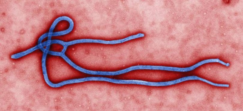 Ebolajárvány: az ÁNTSZ szerint Magyarországon nem kell aggóni