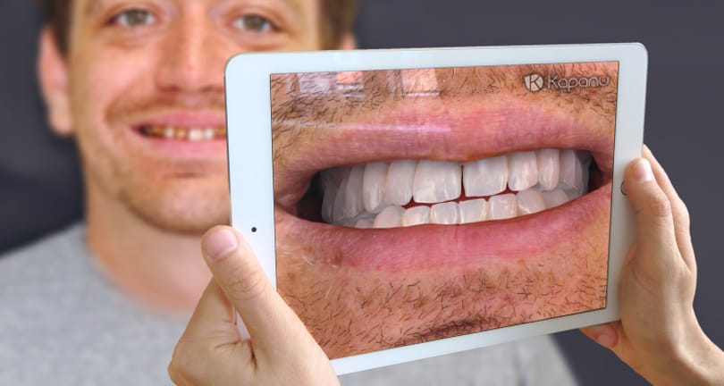 Egy programmal előre látható a fogorvosnál, milyen lesz a végeredmény – videó