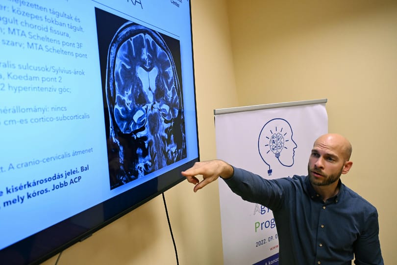 Robbanásszerűen nő majd a demenciában szenvedők száma, elmondjuk, mit lehet tenni a betegség ellen