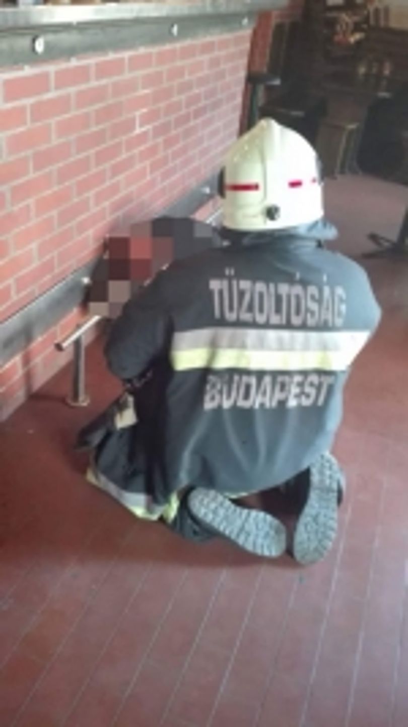 Tűzoltókat kellett hívni a nőhöz, akinek beszorult a feje
