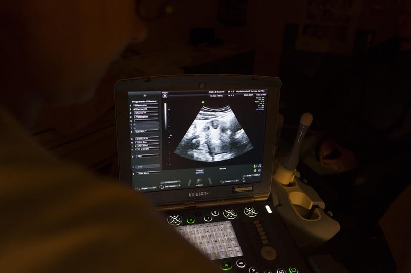 Mi köze a politikának ahhoz, hogy idehaza csökken a legális abortuszt támogatók aránya?