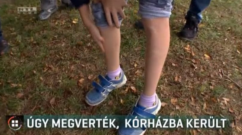 Autista unokatestvérét próbálta védeni a Berkeszen megvert 11 éves fiú