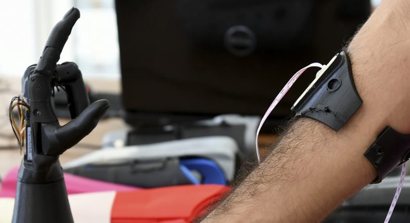 Olyan műkezet tervezett gyerekeknek egy afrikai cég, amely együtt nő használójával