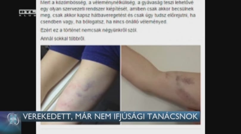Nyomoznak a Fidelitas wellness disznóvágásán kitört verekedés ügyében