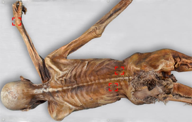 Iceman, azaz Ötzi ősünk tetoválásai