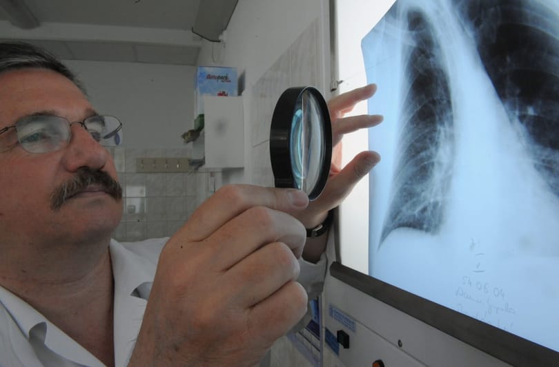 Adókedvezményt kapnak egy városban a szűrővizsgálatokon részt vevők