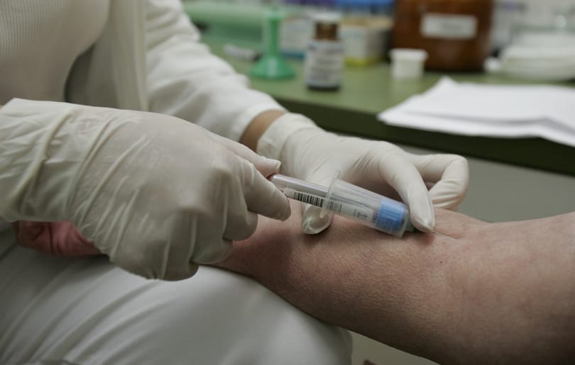 Eltitkolta a HIV-fertőzöttséget egy magyar orvos, hogy munkát kapjon Angliában