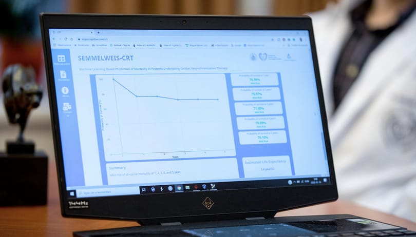 Magyar mesterséges intelligencia segít felbecsülni a szívelégtelenségben szenvedők kockázatait