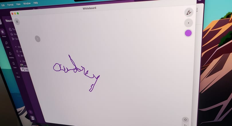 20 év után először tudta leírni a nevét a lebénult nő, aki megkapta a Neuralink agyi chipjét
