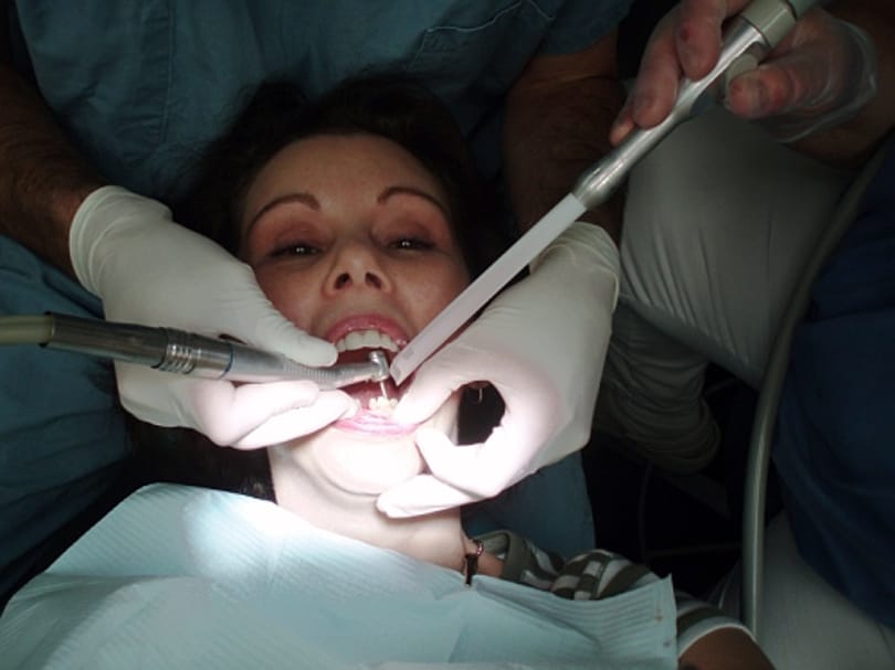 Újdonság a fogászati implantációban: olcsóbb és kevesebb fájdalommal jár