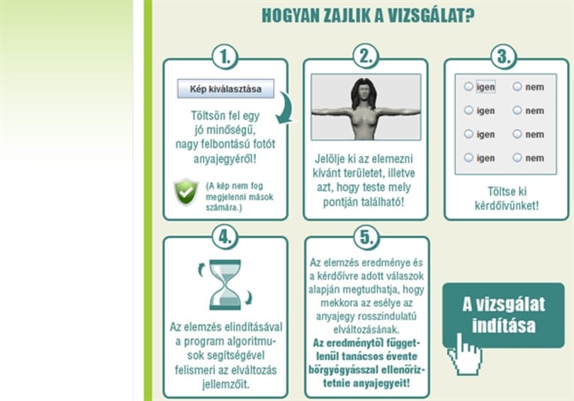 Gyanús az egyik anyajegye? Itt az online melanomaszűrés 