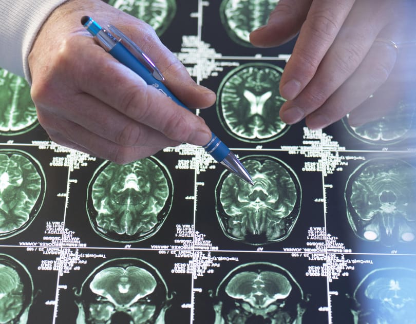 Egérkísérletekből derült ki, hogy mennyire káros lehet a túl gyakori megfázás