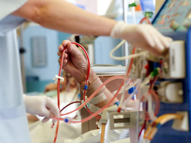 Váratlanul és fű alatt államosítják a TritonLife egy éve megvásárolt művesekezelési üzletágát