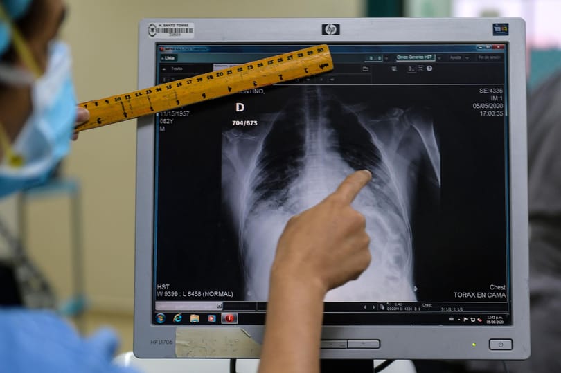 A fekete lyukak sugárzását használhatják röntgenképek készítéséhez a Marson