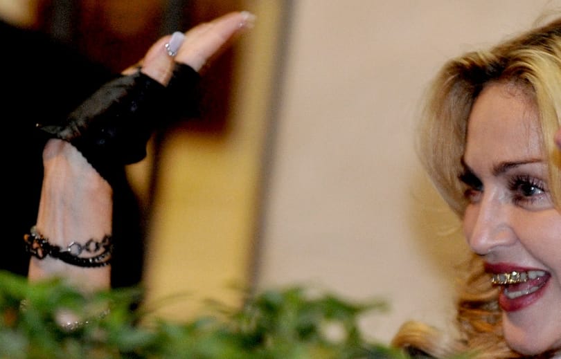 Fotó: Madonna szájában van valami nagyon furcsa