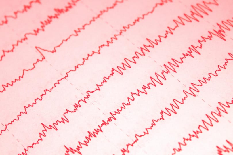 Nagyon más lehet egy ember életkora és biológiai kora – és érdemes megállapítani az utóbbit is
