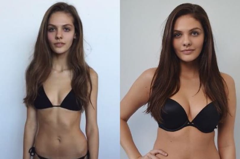 Soványan csak boldogtalan lett, de felszedett 15 kilót, és most menő modell
