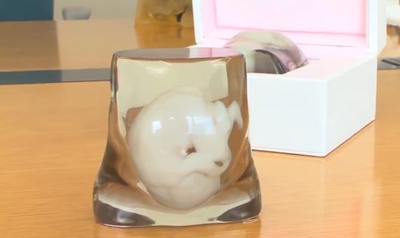 Ahogy eddig senki sem láthatta a magzatot