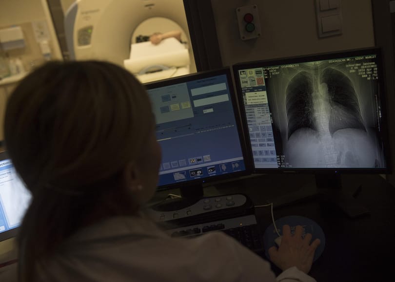 WHO: évek óta először nőtt a tbc-s megbetegedések száma