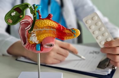 Évtizedeken át gyógyíthatatlannak tartották a hasnyálmirigyrák leggyakoribb formáját, majd jött a 90 százalékos győzelem
