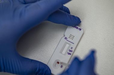 Egy nyomozás leállt, egy még folyik a Covid-tesztek milliárdos biznisze után felszívódott cégek ügyében