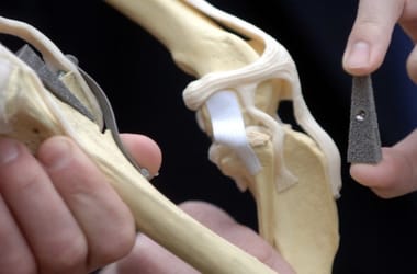 Nem vicc és nem is félreértés: vizeletből csinálnak fog- és csontimplantátumot