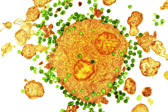 Egy mRNS-módszer csalogathatja elő a szervezetben rejtőző HIV-vírust, hogy aztán végleg elpusztítható legyen