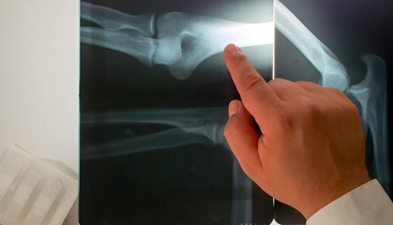 Röntgenszeműek lesznek az okostelefonok: csomagokba lehet majd belátni velük