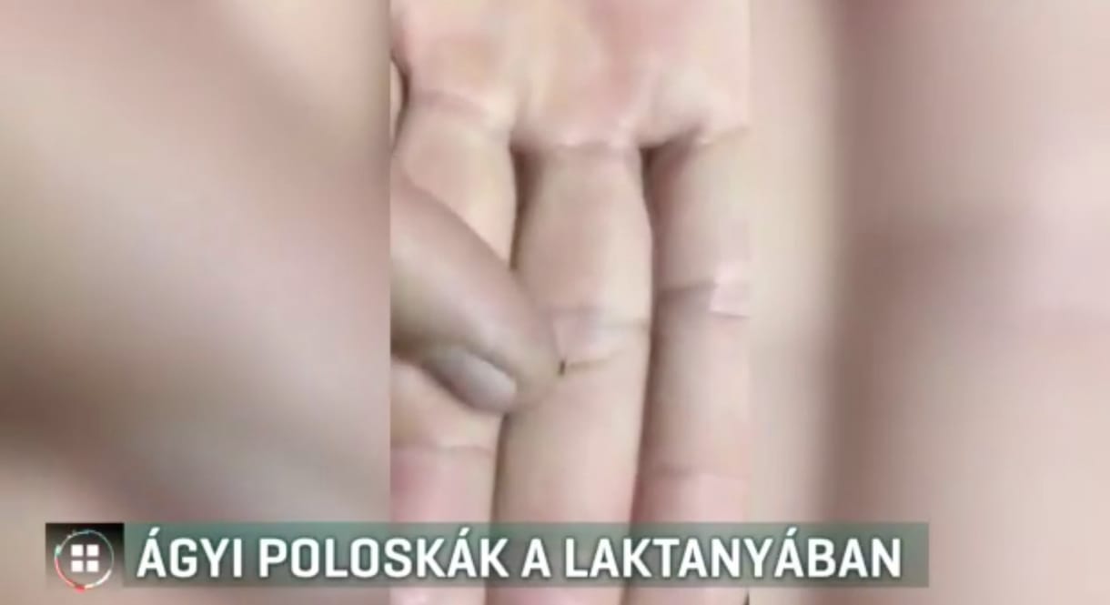 Ágyi poloskákra panaszkodnak a győri tűzoltó laktanyában