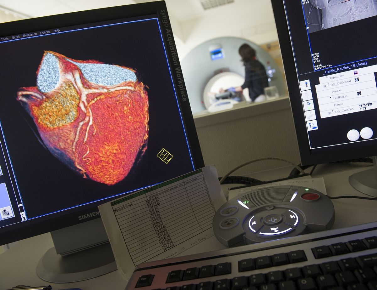 Várólista-felezés: az idei rákdiagnosztikai keretből csak jövőre lehet valami