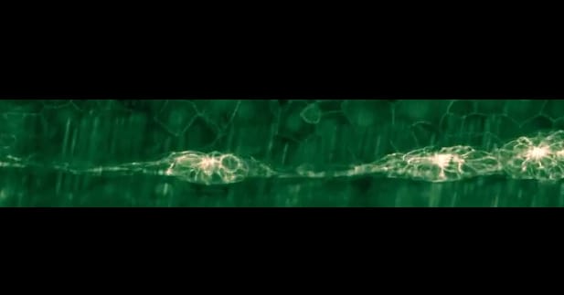 Elképesztő felvételek: ezek a világ legjobb mikroszkópos videói