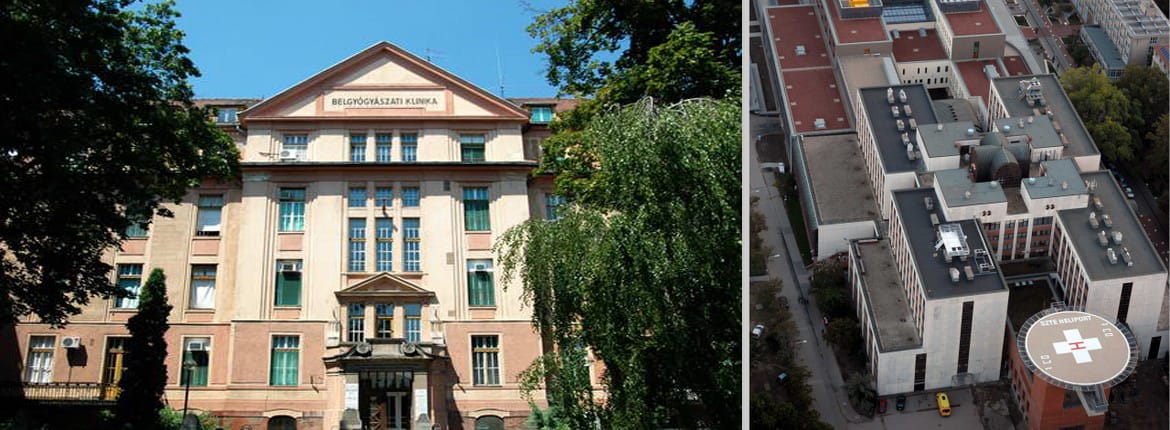 Felvételi zárlat koronavírus miatt a szegedi szívsebészeti osztályon