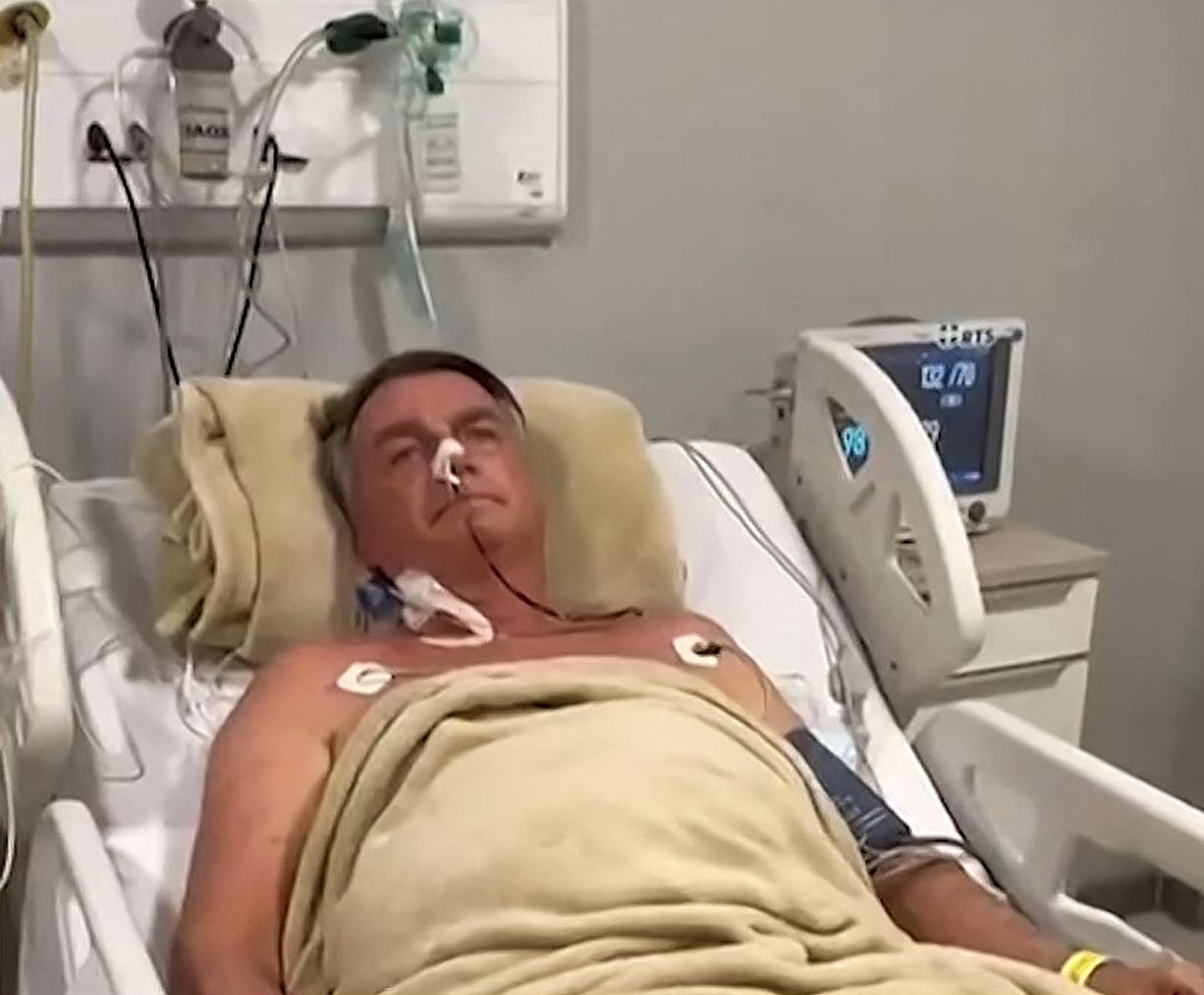 Romlott Bolsonaro állapota, intenzív osztályon kezelik