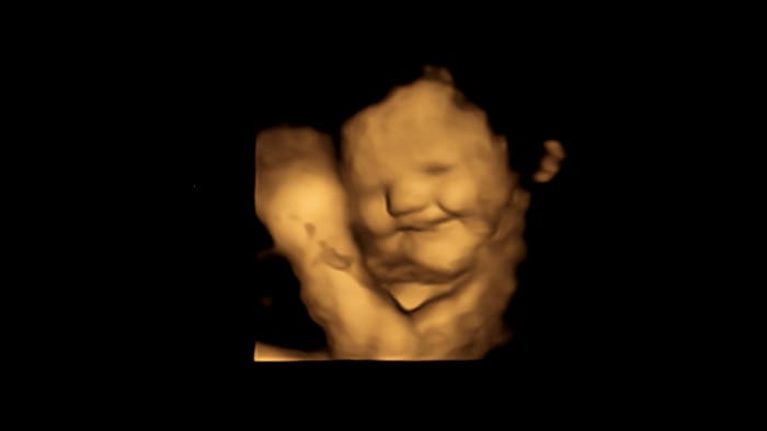 4D-s ultrahangképek szerint a méhben lévő baba mosolygó arcot vág, ha az anya répát eszik