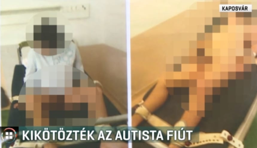 Kikötözött fiú: a kaposvári kórházban úgy gondolják, nem hibáztak