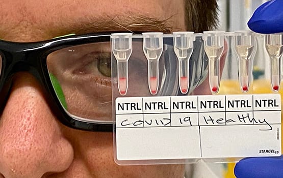 A vírusfertőzést 20 perc alatt kimutató tesztet készítettek ausztrál tudósok