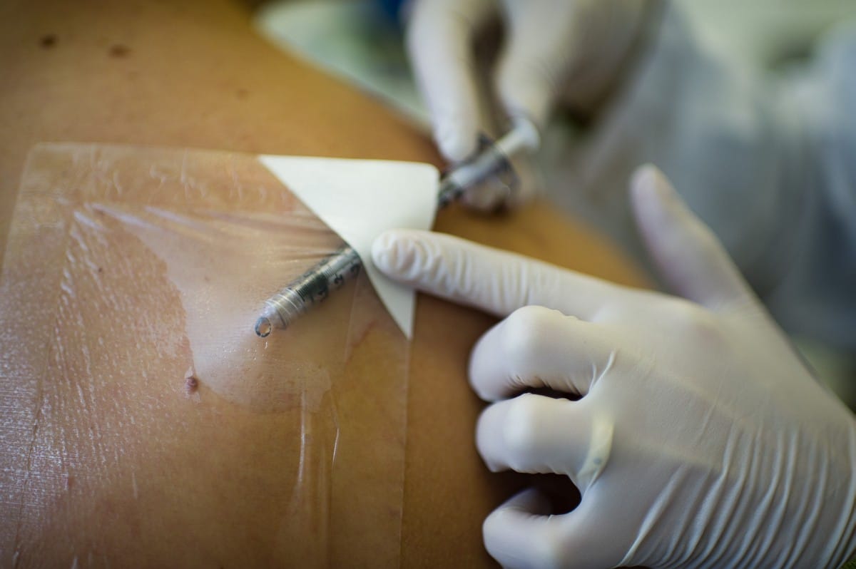 Magyar Nemzet: Egyre több itthon a HIV-fertőzött